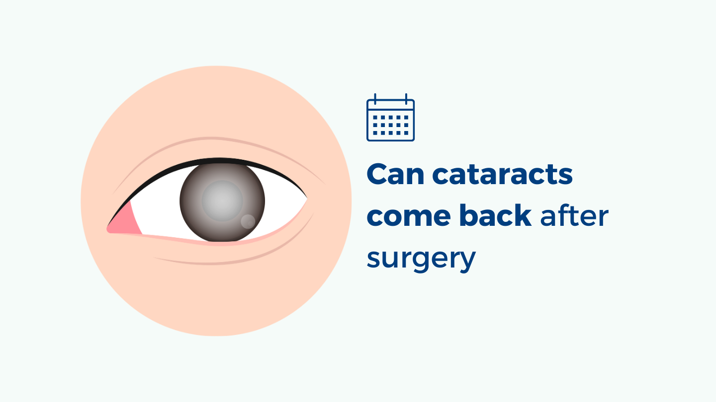 Can Cataracts Come Back After Surgery? Free State Eye and Laser