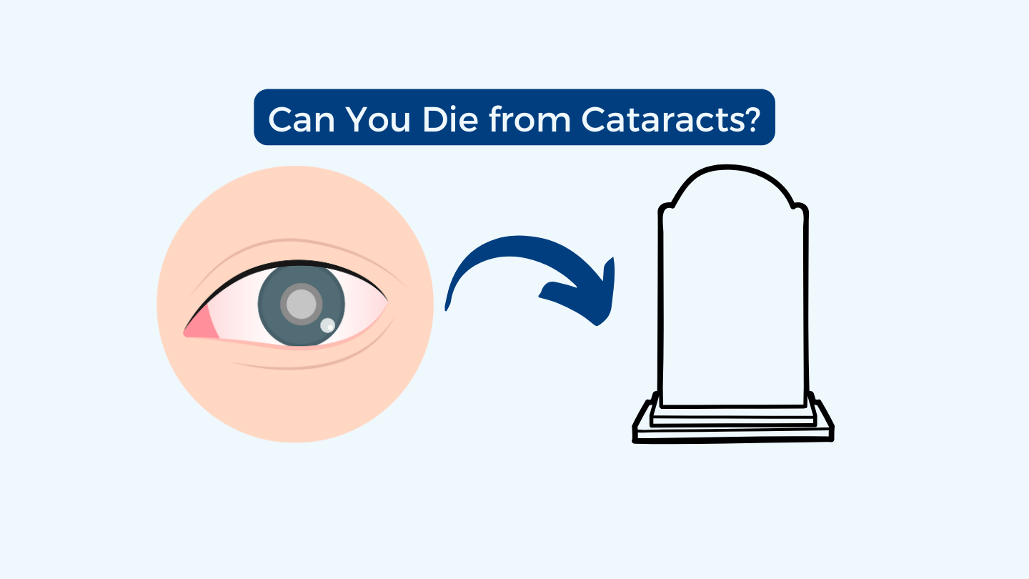 Can You Die from Cataracts? Free State Eye and Laser