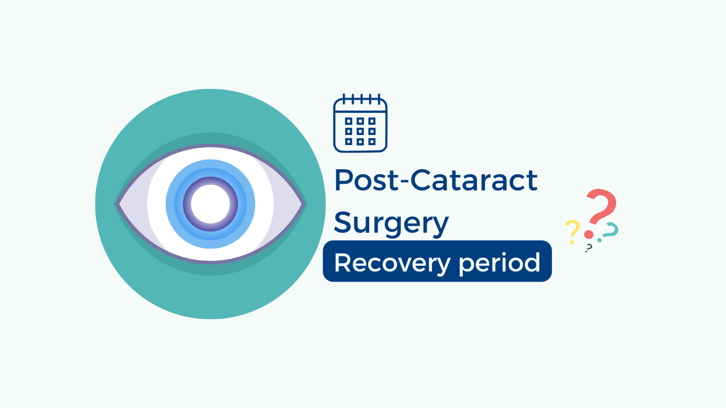 How Long is the Recovery Period for Cataract Surgery? Free State Eye
